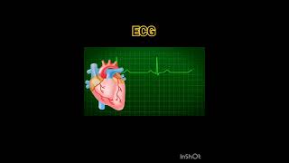 Electrocardiogram Electrocardiography ECGEKG  basics How to Perform an ECG  Electrocardiogram [upl. by Notgnihsaw932]