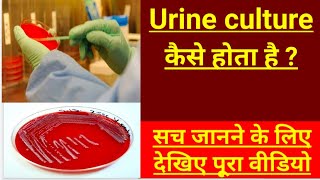 Urine Culture Test in Hindi  culture test kya hota hai  cs test of urine [upl. by Airretnahs]