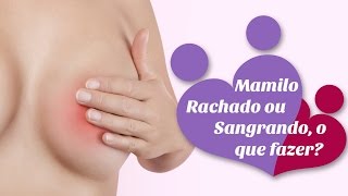 Mamilo rachado ou sangrando o que fazer [upl. by Ty]