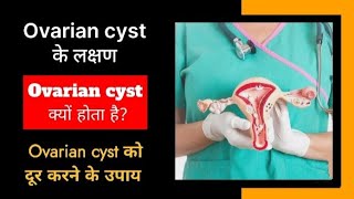 Ovarian cyst causes symptoms and treatment  Ovarian cyst से छुटकारा पाने के उपाय ovariancyst [upl. by Okiam]