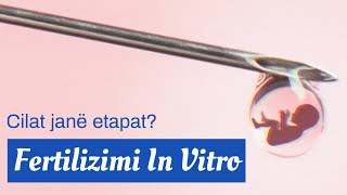 IVF Fekondimi In Vitro nga fillimi në fund [upl. by Giah]