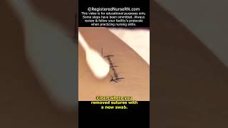 How to Remove Stitches Sutures Nursing Clinical Skill shorts nursing nurse [upl. by Maura821]