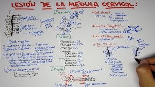 Lesión de la médula cervical  trauma vertebro medular [upl. by Lundberg998]