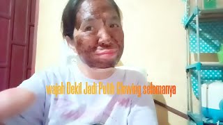 Wajah Dekil Jadi Glowing Cuma Pakai Masker 3 Bahan [upl. by Sioled]