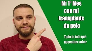 Mi 1º mes con mi trasplante de pelo Información cómo dormir prohibiciones y consejos [upl. by Alomeda]