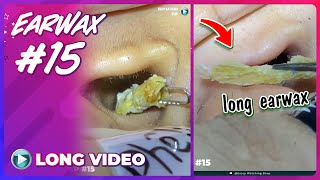 EP 15 Earwax ASMR Earwax removal video will make you relax Keep your ears clean [upl. by Ashford702]