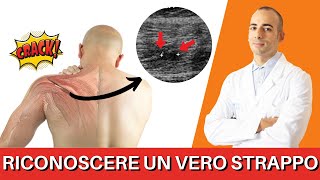 Come riconoscere un VERO strappo muscolare alla spalla e cosa fare [upl. by Sajet]