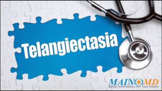 Telangiectasia ¦ Treatment and Symptoms [upl. by Crabb]