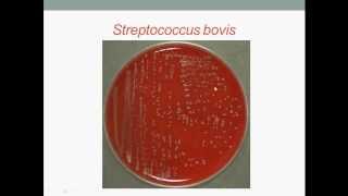 Bacteriology Streptococcus Gram Positive Cocci [upl. by Godewyn297]