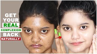 Get your REAL COMPLEXION BACK NATURALLY  My Story  Anchal Shukla [upl. by Tammy]