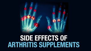 Side effects of Arthritis Supplements  Dr Gaurav Sharma  Defeating arthritis [upl. by Elbertina]