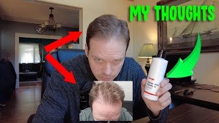 Keeps Biotin Mens Shampoo for Thinning Hair Review  2 months RESULTS [upl. by Valida695]