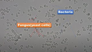 Bacteria and Fungus Microscopy at Various magnifications 400X 800X and 1600X [upl. by Aleekahs]