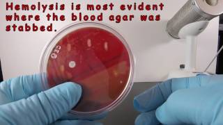 Beta Hemolysis on Blood Agar [upl. by Lucio]