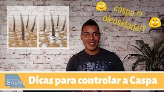 cuidados com cabelo Oleoso e com CaspaTerapia Capilar [upl. by Rayham]