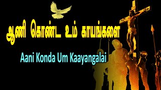 ஆணி கொண்ட உம் காயங்களை  Aani Konda Um Pathangalai [upl. by Evars]