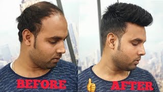 a non surgical hair clipping system wig for man in delhi amp agra by master RIZY [upl. by Sakiv]