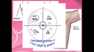 Mammography 2 [upl. by Netfa]