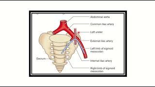 High anterior resection structures injury MRCS question solve CRACK MRCS [upl. by Nilak734]