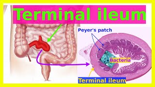 terminal ileum [upl. by Amo]