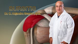 Bursitis Consejos Útiles y Tratamiento [upl. by Jordain]