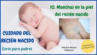 10 Manchas en la piel del recién nacido Curso cuidados del recién nacido para padres [upl. by Kung204]