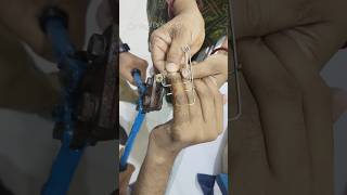 Suzuki Frame K wire Removal Procedure  Dr Prateek Joshi ortho kwire shorts [upl. by Nahn]