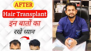 Precautions of The After Hair Transplant  जानिए हेयर ट्रांसप्लांट के बाद की सावधानिया [upl. by Autrey513]