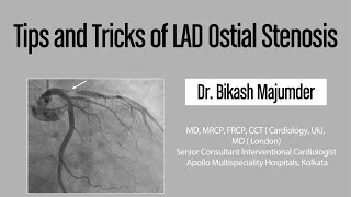 Tips and Tricks of LAD Ostial Stenosis [upl. by Hartman976]