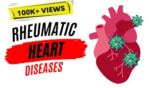 Rheumatic heart disease  Rheumatic fever [upl. by Minabe321]