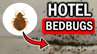 Bed Bugs in Hotels How to Protect Yourself from Infestation [upl. by Hawker]