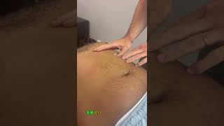 Lower back pain relief with shockwave therapy to the ABS [upl. by Johannes]