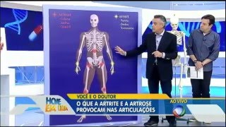 Artrite e artrose saiba como prevenir e tratar no Você e o Doutor [upl. by Wang618]