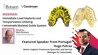 Immediate Loading Implants with a Modelless Approach for Full Control of the Final Outcome [upl. by Notgnillew992]