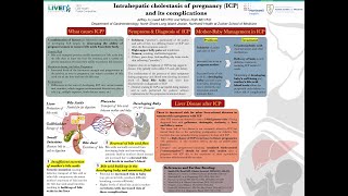 Intrahepatic Cholestasis of Pregnancy ICP and its Complications Jeffrey Lowell MD [upl. by Suiradal]