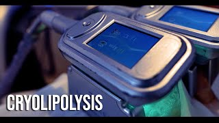 Cryolipolysis Fat Freezing  Cryojuvenate [upl. by Aysab]