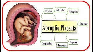 ABRUPTIO PLACENTA Definition Risk Factors Pathogenesis and Management [upl. by Enamrahs85]