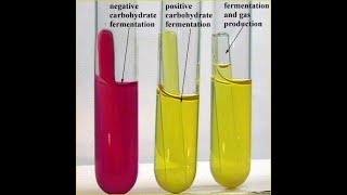 Sugar Fermentation Test [upl. by Matt]