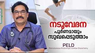 നടുവേദന മാറാൻ ഏറ്റവും എളുപ്പ മാർഗം  Back Pain Treatment in Malayalam Health Tips [upl. by Lunseth958]