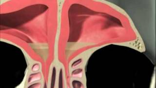 3D Sinus Animation [upl. by Elisabet]