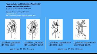 The freshwater ciliates Cyclidium glaucoma and C hepatrichum [upl. by Irtimed113]