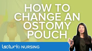 How To Change An Ostomy Pouch  Explanation amp Demonstration  Lecturio Nursing [upl. by Russi93]