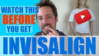 WHAT IS INVISALIGN [upl. by Risa]