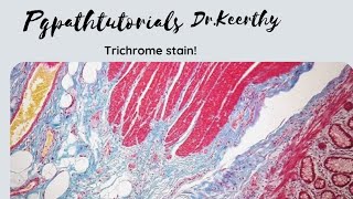 Masson trichrome stain [upl. by Elke1]