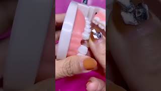 False teeth Molder Repair Gap Tooth How to use model bead🦷 repaircheapsavemoneyfillfixtooth [upl. by Ynatsed]