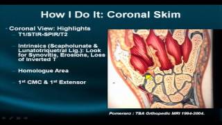 Wrist Part IV How to Use the Coronal Projection to Evaluate Wrist Pathology [upl. by Enilekcaj]