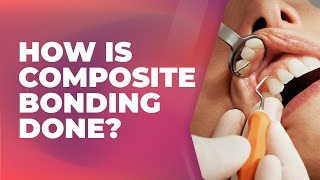 How is composite bonding done  Cosmetic Dentist Preston [upl. by Philbin]