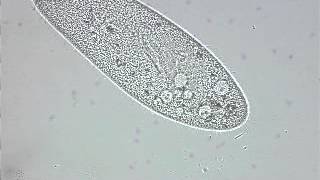 paramecium contractile vacuole [upl. by Aihsemek]