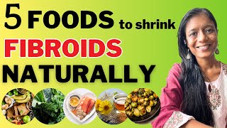 Fibroids Diet 5 Foods to Shrink Fibroids Naturally [upl. by Mal232]