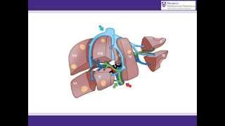 ALPPS procedure animation  A surgical solution for initially unresectable liver tumours [upl. by Aillimac]